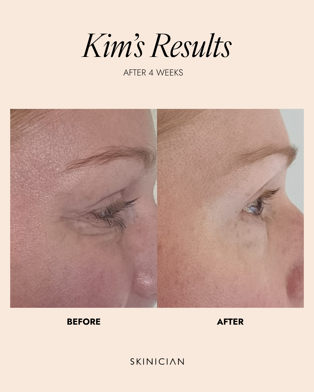 Skinician PEPTIDE EYE COMPLEX 15ML