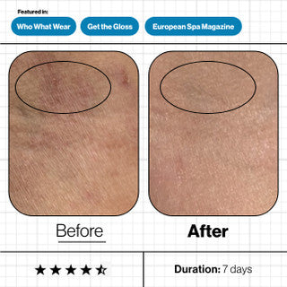 Skin Moisture IQ (28 day supply)