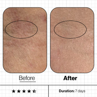 Skin Moisture IQ (28 day supply)