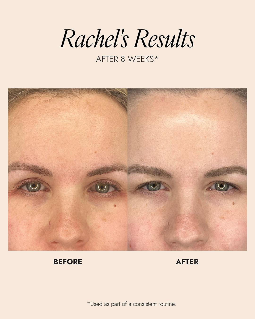Skinician GLYCOLIC ACID EXFOLIATING TONER 100ml