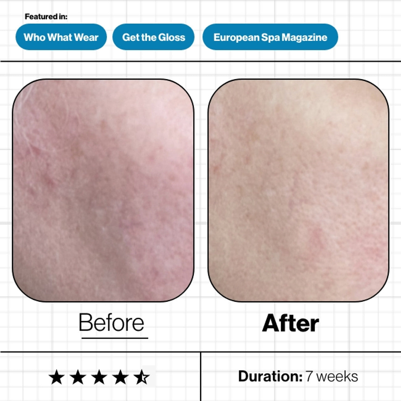 Skin Moisture IQ (28 day supply)