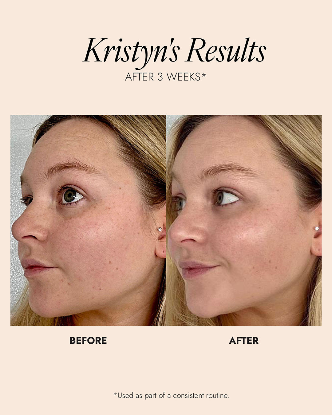Skinician PRO-RADIANCE ENZYME CLEANSER 150ML