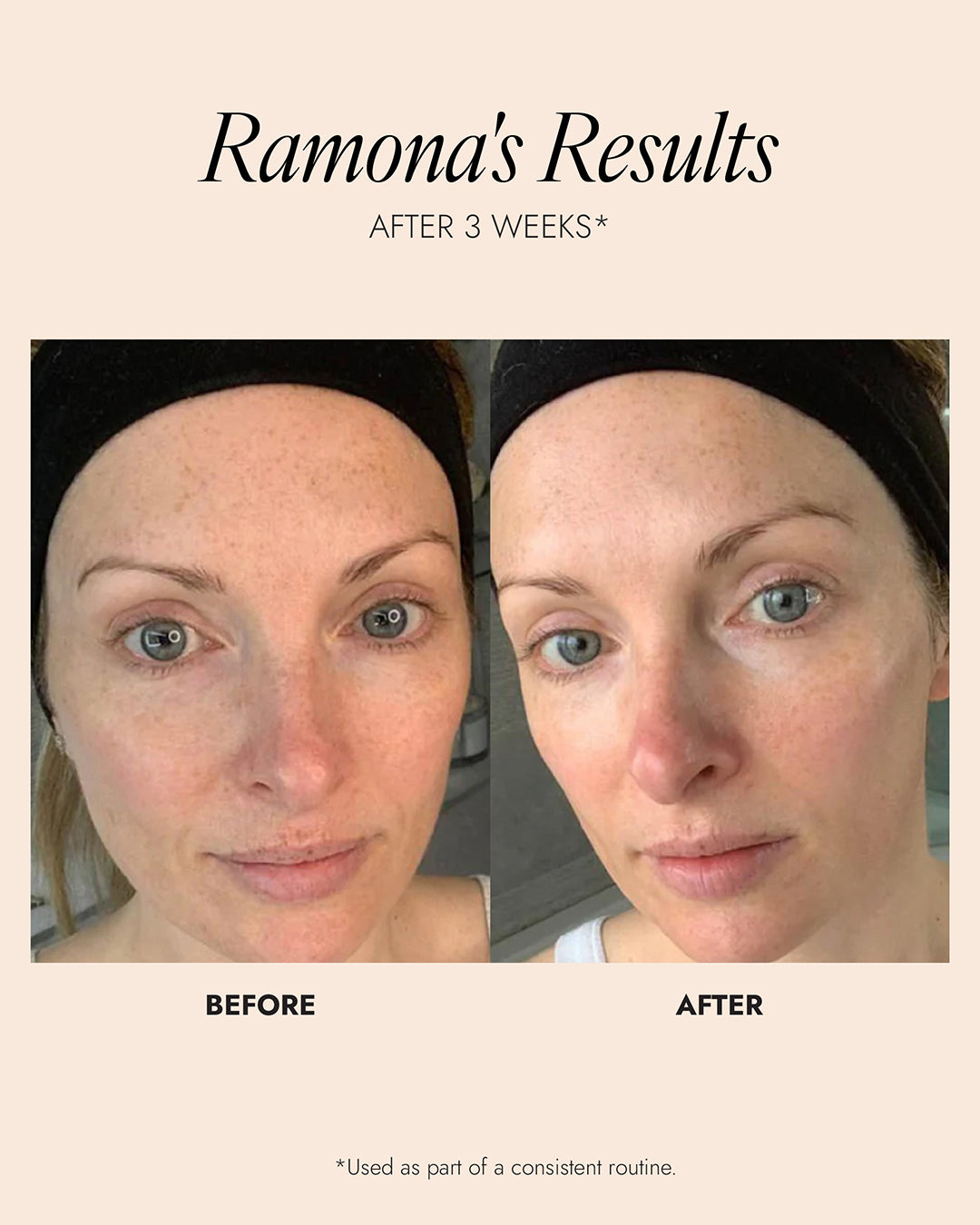 Skinician PRO-RADIANCE ENZYME PEEL 50ML