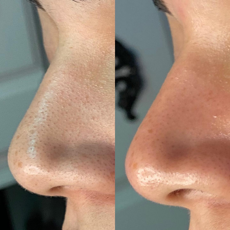 Reform Repair & Renew Gel