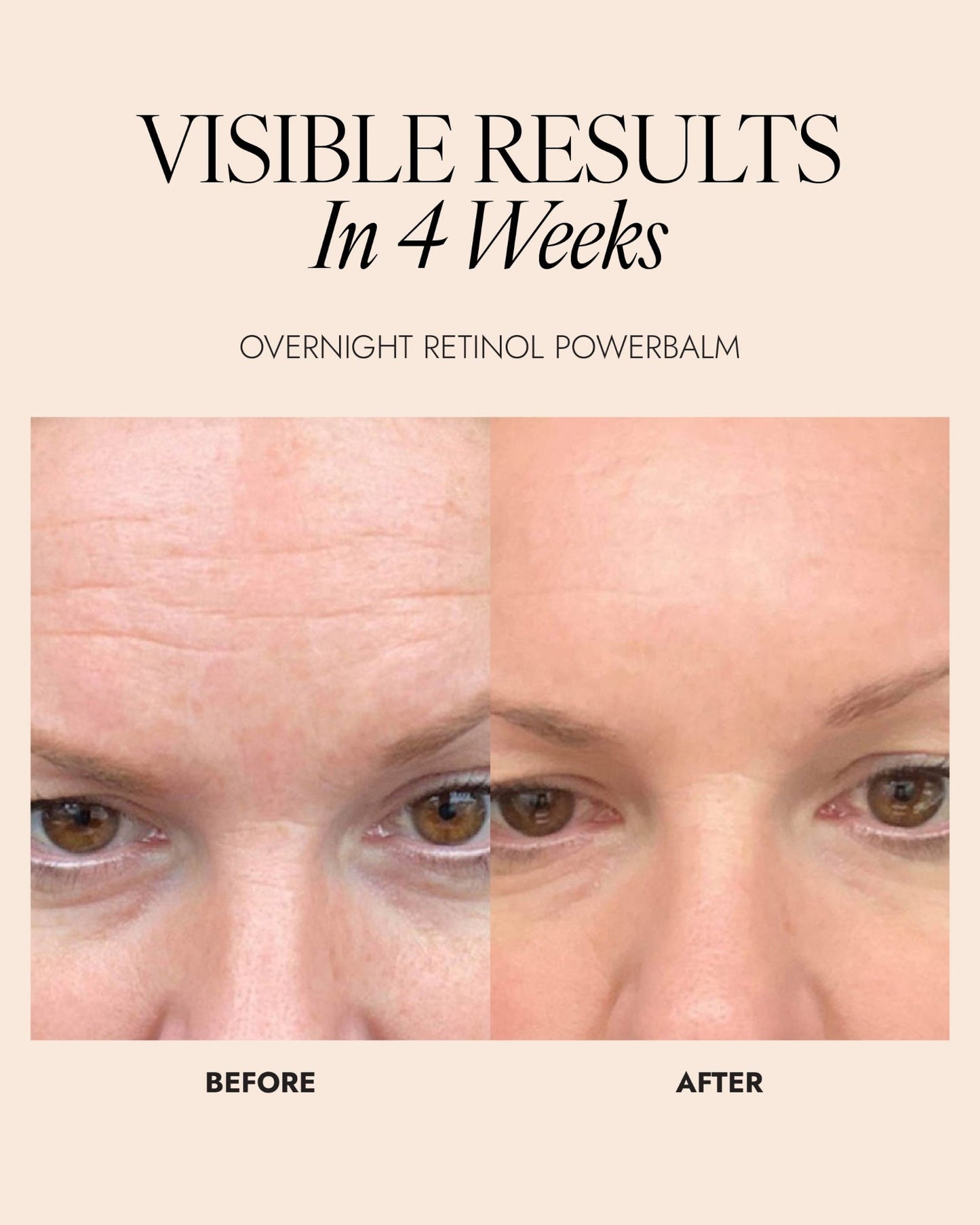 Skinician OVERNIGHT RETINOL POWERBALM 50ML