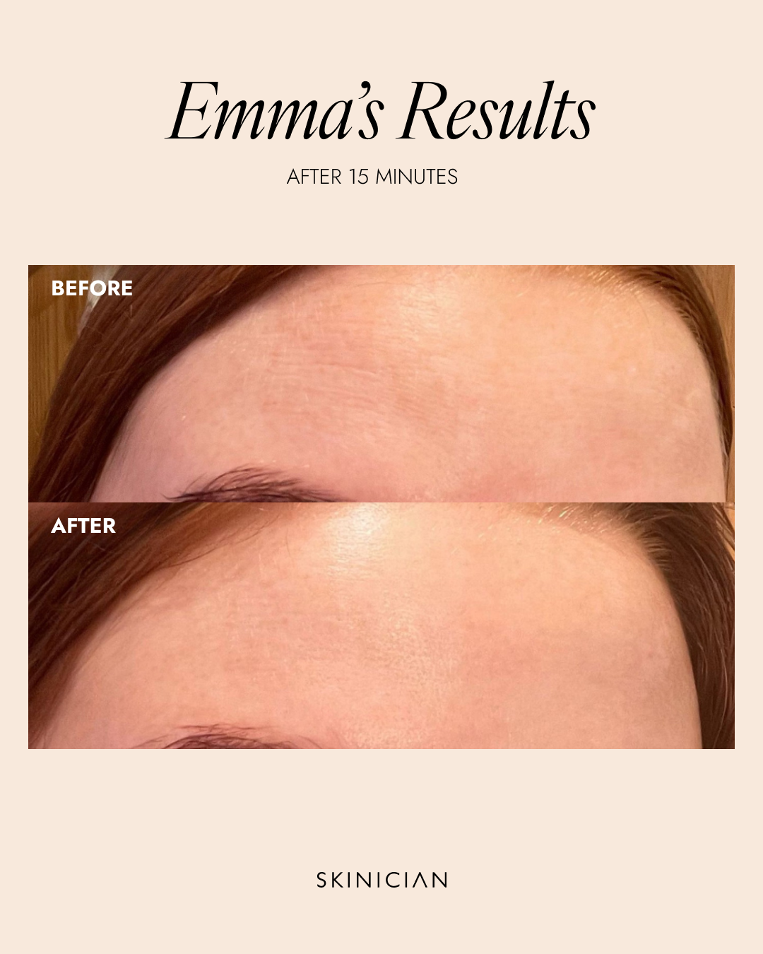 Skinician PEPTIDE LIFT & FIRM SERUM 50ml