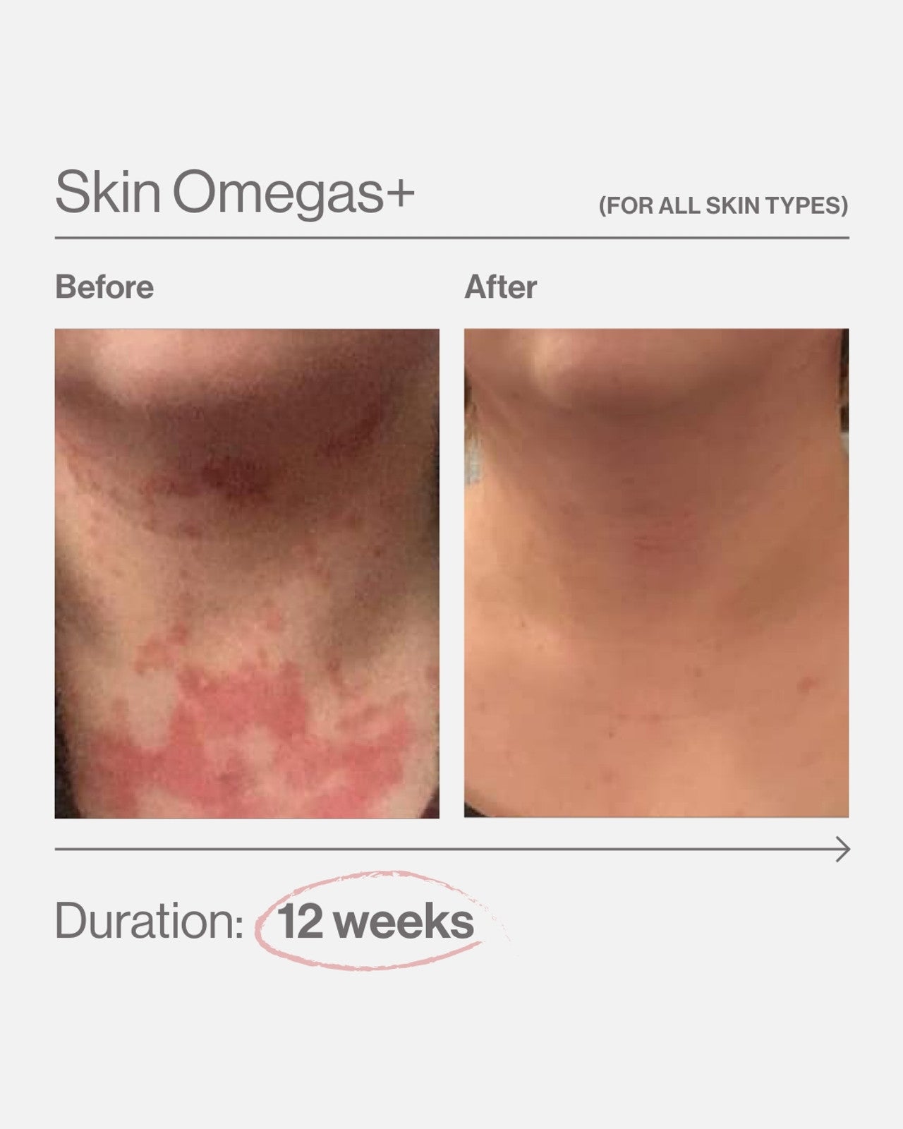 Skin Omegas+ (60 Capsules)