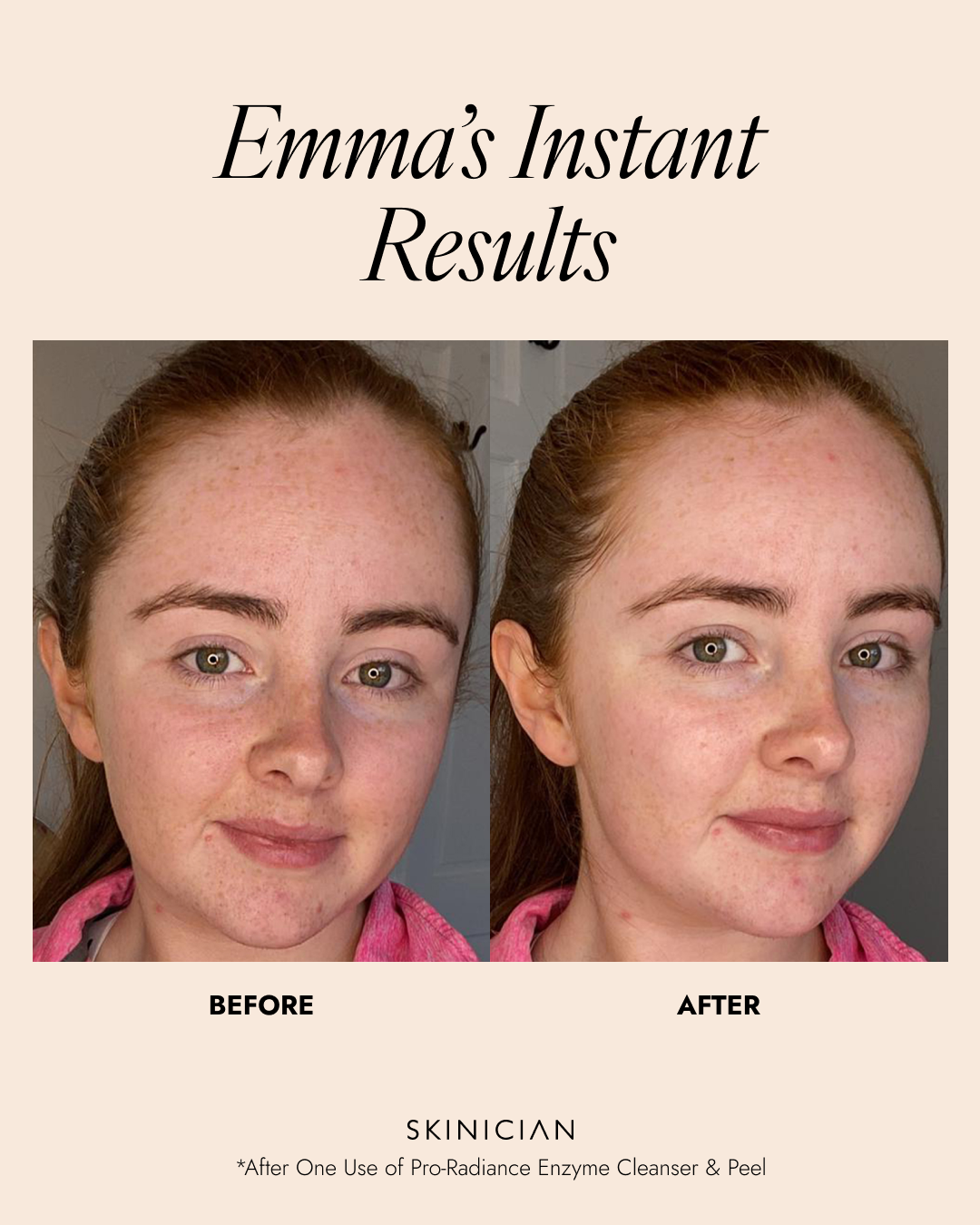 Skinician PRO-RADIANCE ENZYME PEEL 50ML