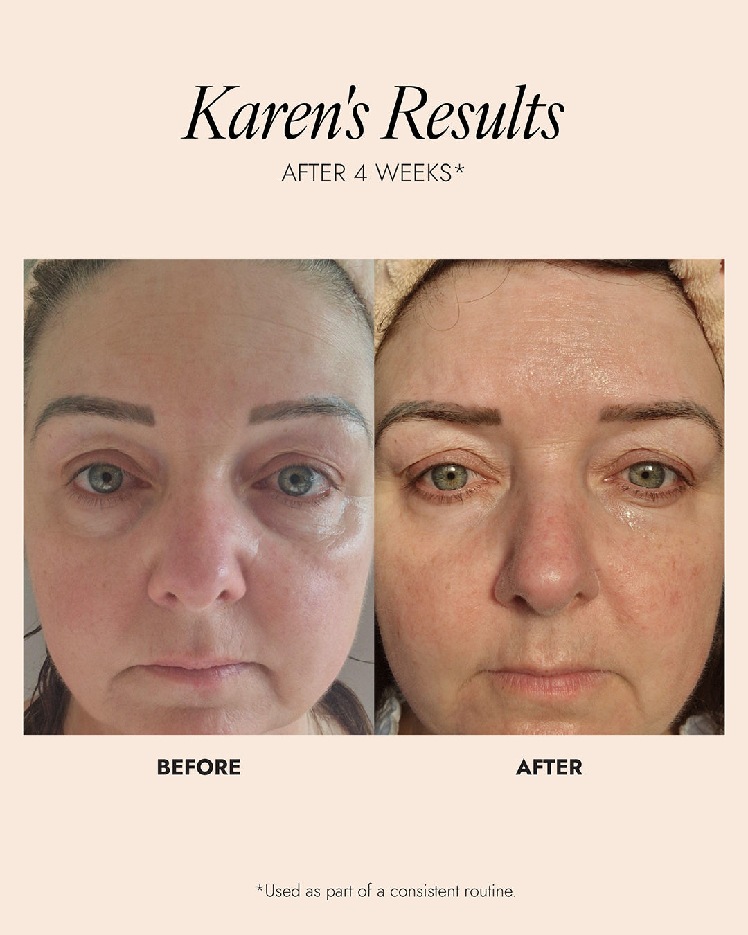 Skinician PEPTIDE EYE COMPLEX 15ML