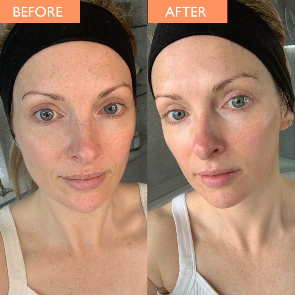 Skinician - PRO-RADIANCE ENZYME PEEL 50ML