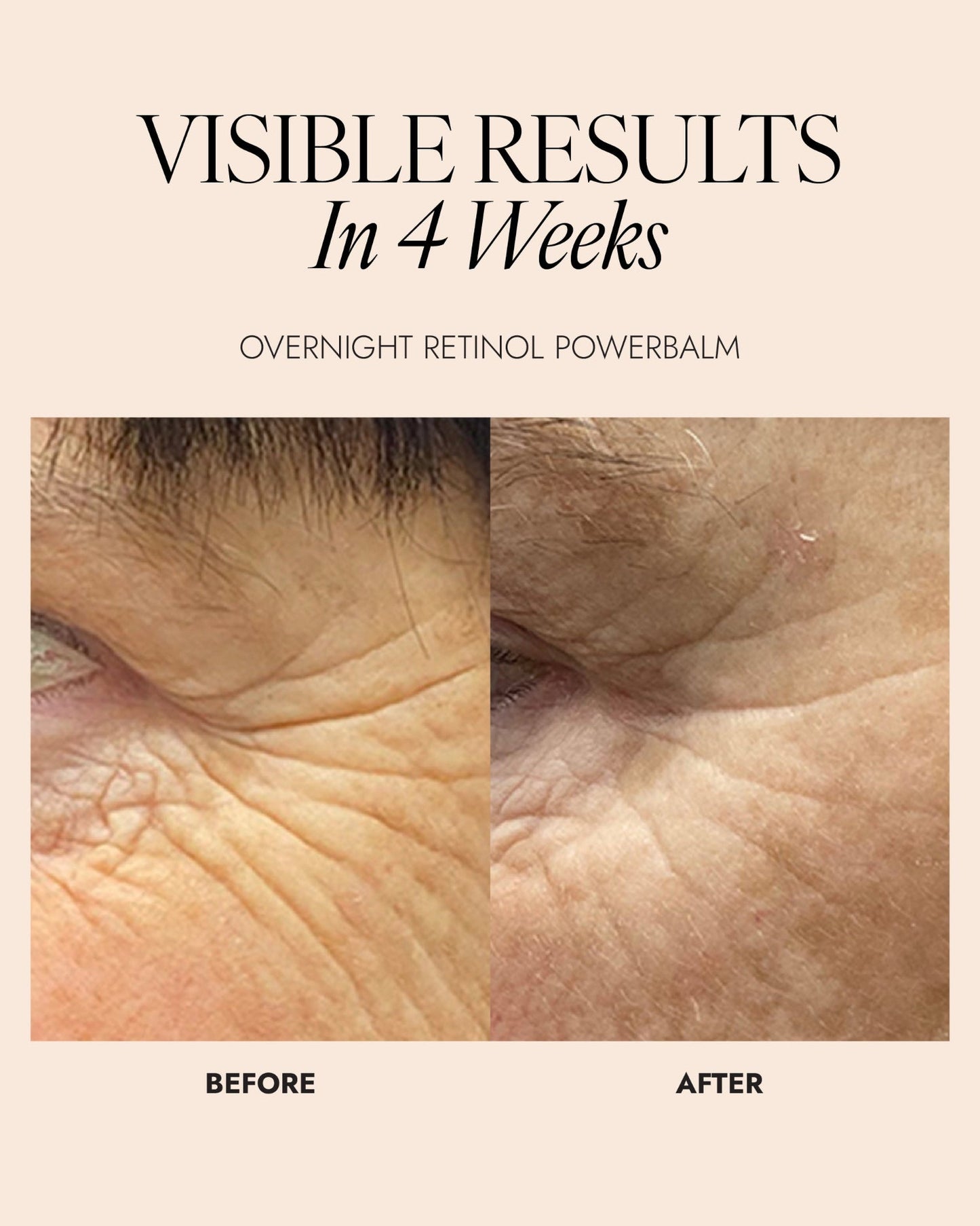Skinician OVERNIGHT RETINOL POWERBALM 50ML